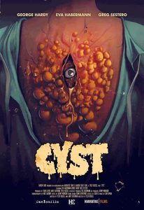 فيلم Cyst 2020